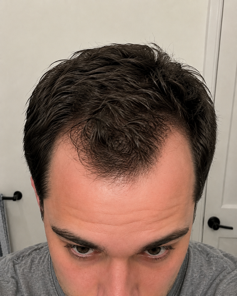 Day 0