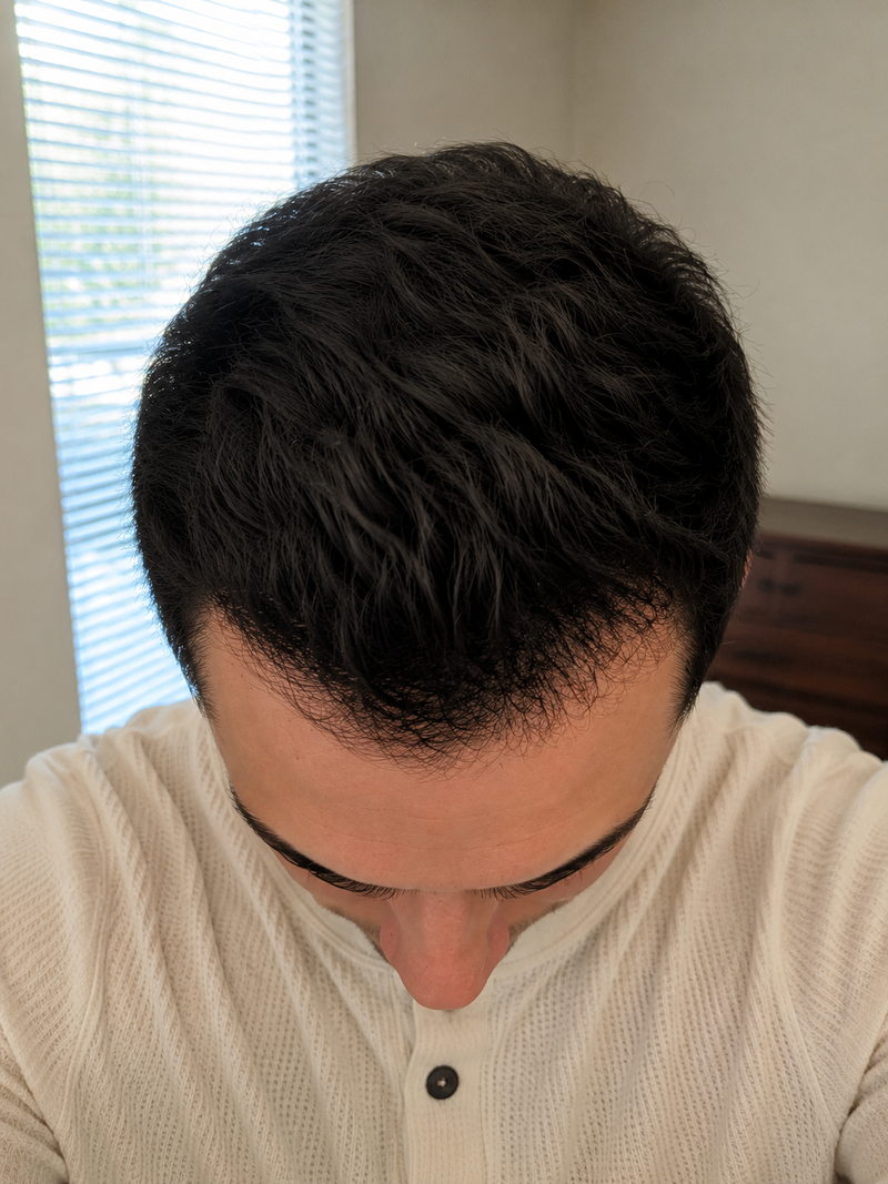 Week 17