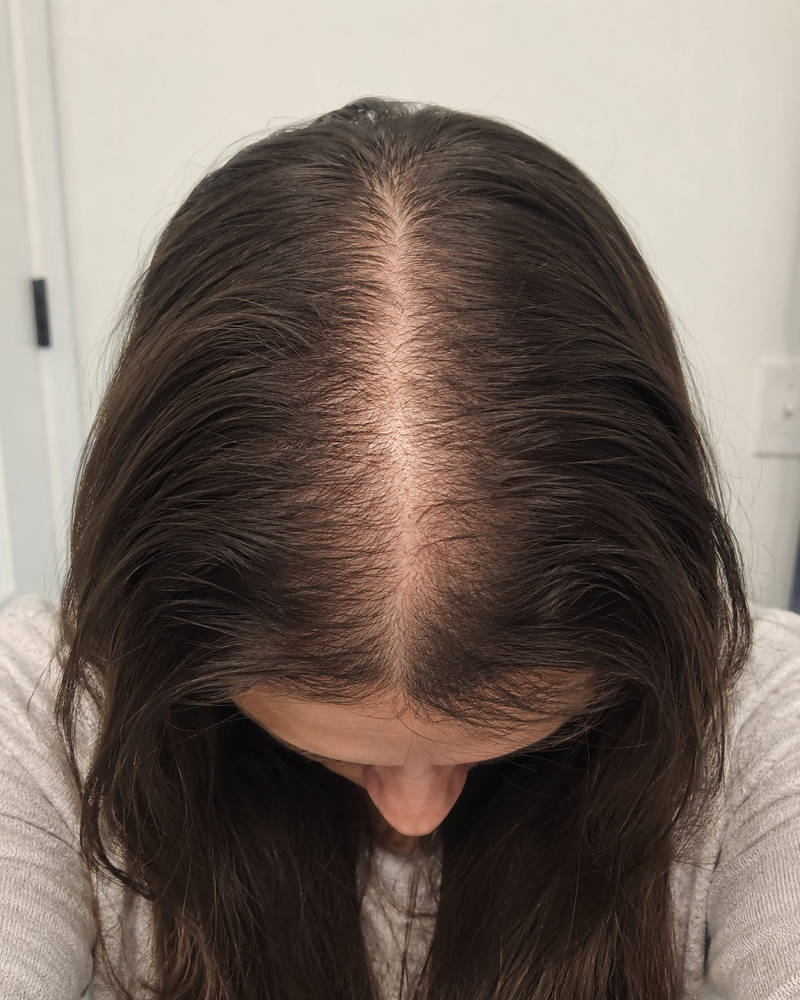 Day 0