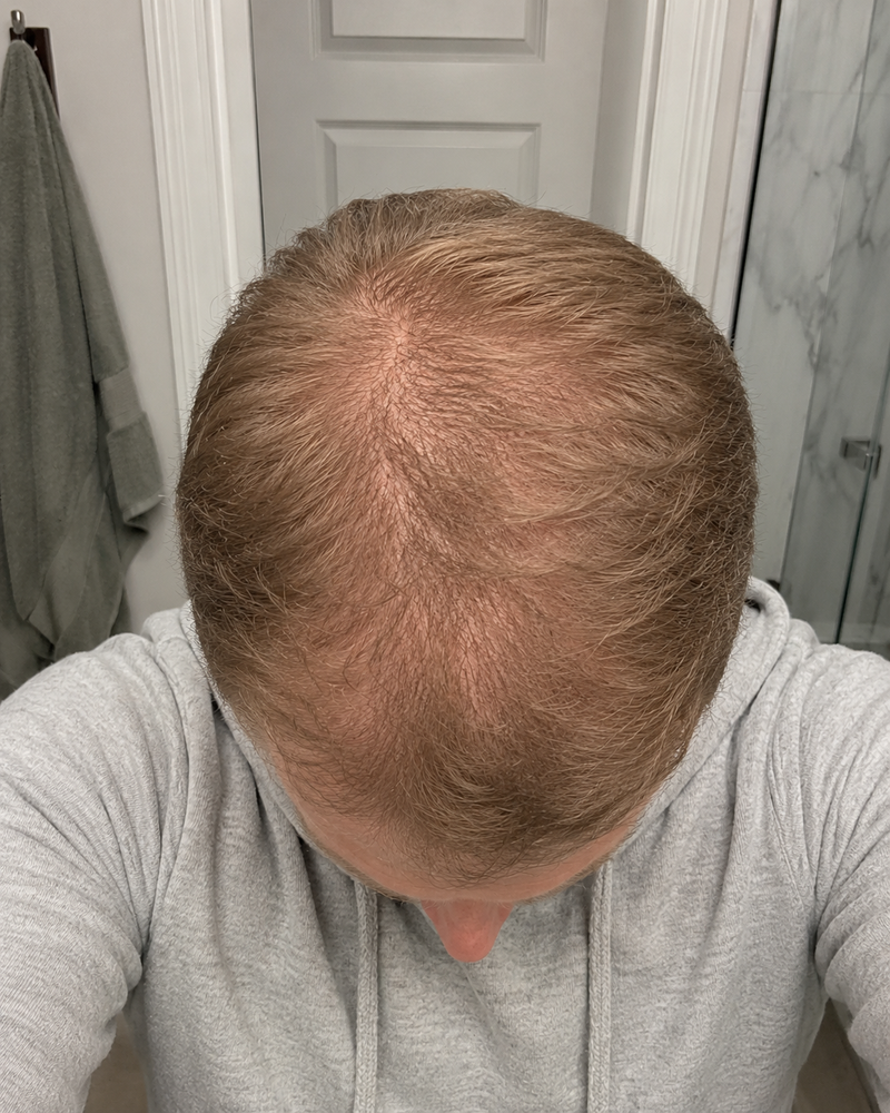 Week 4