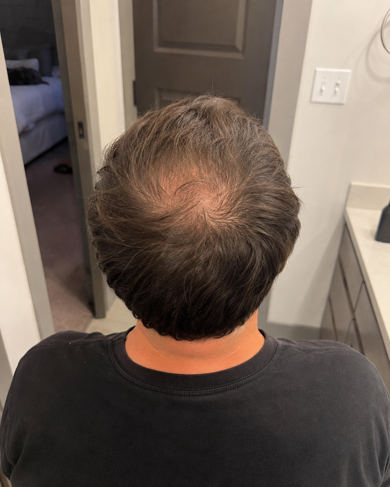 Day 0